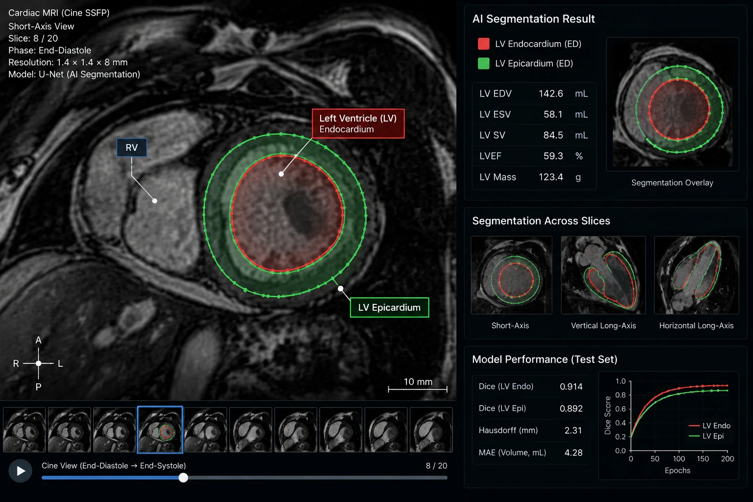 Cardiovascular scan